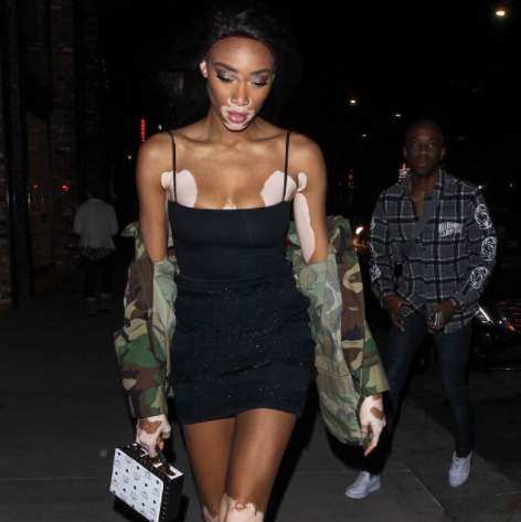 The Kimia Bodysuit on Winnie Harlow in Who What Wear